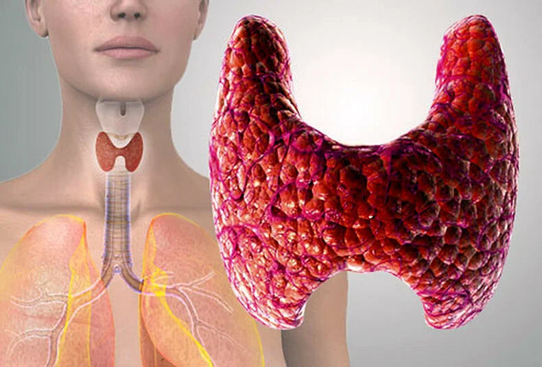 Болезни щитовидной железы могут стать причиной как гипер-, так и гипотермии